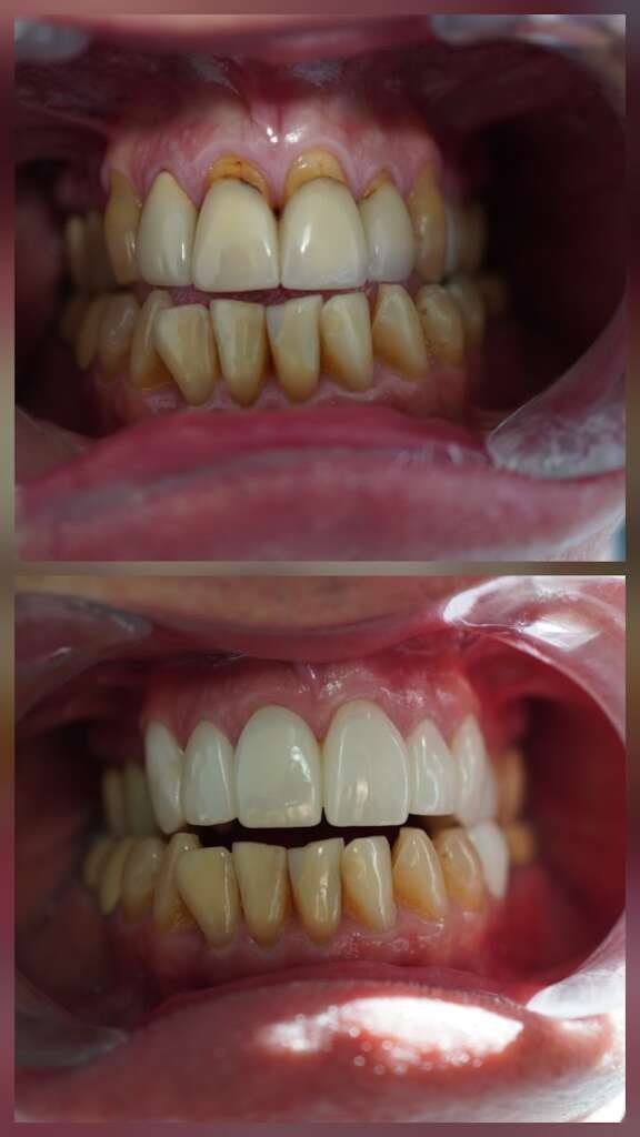 Precious Dental